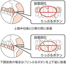 リップルくん 基準値